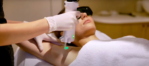 epilation electrique ou laser