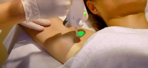 meilleure epilation