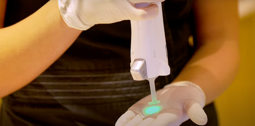 epilation laser peau noire