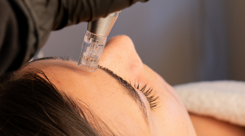 Une femme brune réalise un traitement microneedling dans un centre d