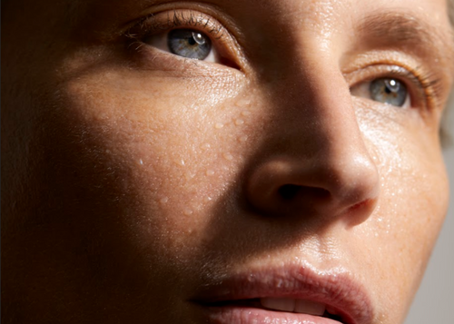 Choisir entre Peeling, PRX-T33 ou Hydrafacial
