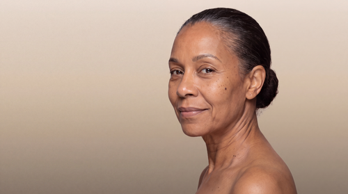 WRINKLES & LOSS OF FIRMNESS