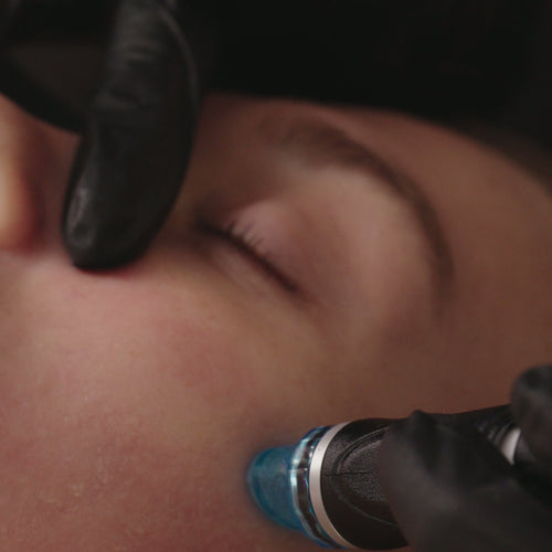Hydrafacial® - Qu'est-ce que c'est